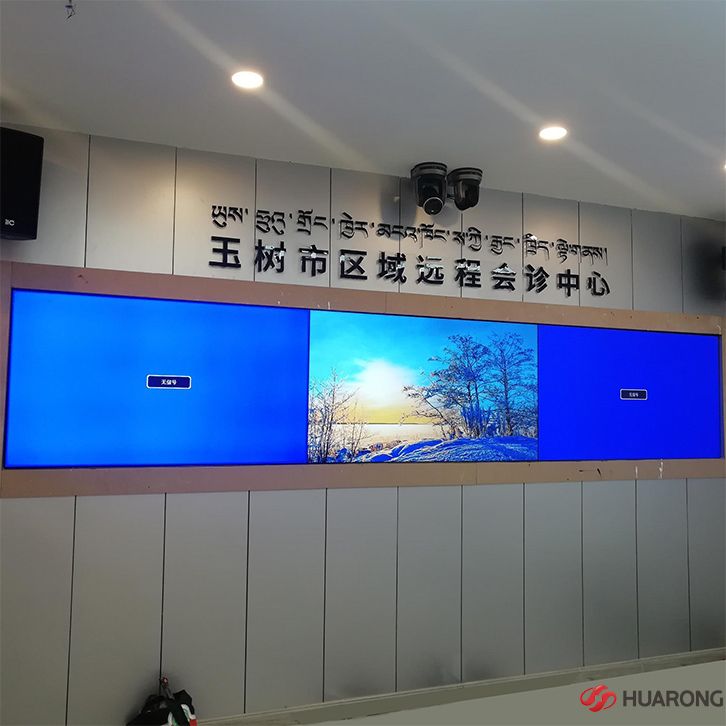 青海65寸3.5mm拚縫精品国产精品国产偷麻豆會診中心